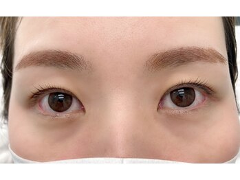 シスタス(Cistus)/ダブルアイリフト