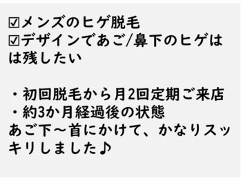ニコ アンド キャンディー(Nico.&Candy)/脱毛は夏前に！