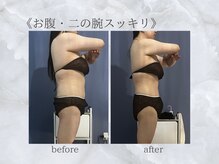 ジュプン 長崎/筋膜リリースで全身痩せ！