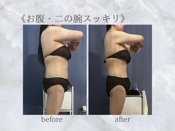 ジュプン 長崎/筋膜リリースで全身痩せ！