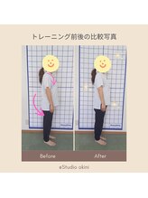 オキニ(okini)/腰痛改善　before　after