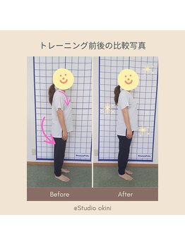 オキニ(okini)/腰痛改善 before after