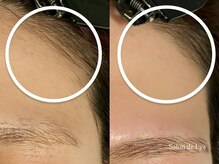 サロン ド リス 岐阜北方(Salon de Lys)/おでこwax