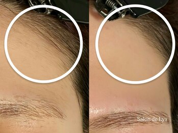 サロン ド リス 岐阜北方(Salon de Lys)/おでこwax