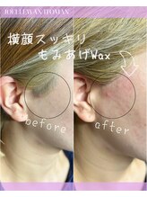 ジョエルワックス 沖縄糸満店(JOELLE WAX)/横顔スッキリもみあげWax