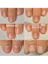 ニコプラス(NICO+)/自爪育成パラジェルクリア補強