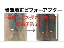 やち鍼灸院/骨盤を整えて腰痛予防にも！