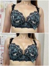 バーディー(BIRDIE)/施術１回/4０代