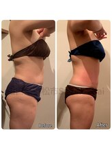 サロンドカイ(Salon de Kai)/痩身プログラム2ヶ月