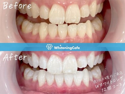 ホワイトニングカフェ 原宿店の写真