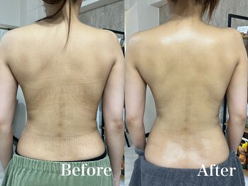 マシェ バイ マユ(Mache by Mayu)/全身つるん！スリムになるハーブ