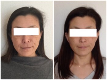 美容整体ウェリナ あま甚目寺院/小顔矯正/骨盤矯正/美脚サロン