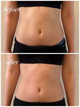 シャルマン(Charmant)/プウアボーテ1時間着用