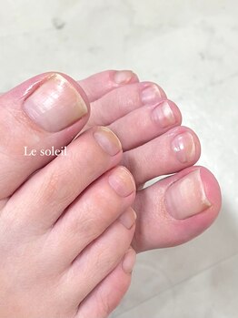 ル ソレイユ(Le soleil)/フットネイルケア by mikiko
