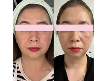 アンド(and...)/小顔レモンボトルxフェイスWAX