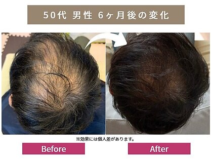 リアン 目黒(Re-Ane)の写真