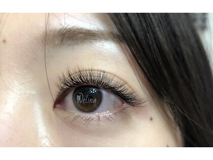 ウェリナ(Welina)の写真