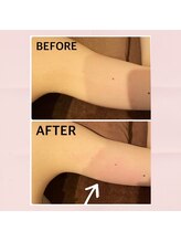 ウナ デ リンゴル 恵比寿店(UNA de Ringol)/夏に向けた二の腕づくり★