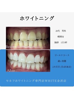 ホワイト 金沢店/ゴールドコース週一通いのお客様
