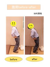 いみすぽ整体/50代男性ビフォアアフター