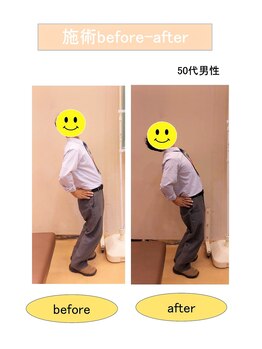 いみすぽ整体/50代男性ビフォアアフター