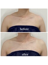 カプリス(CAPRiCE)/リンパドレナージュ