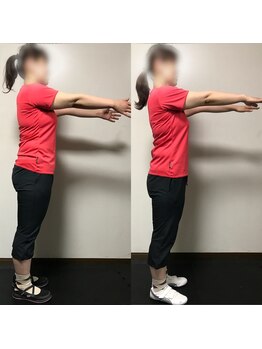 インペリアルボディ(Imperial Body)/Before After 30代女性 Y様