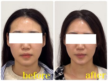 コガオラウンジ 新宿店(KOGAO LOUNGE.)/