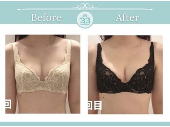 美人バスト 静岡店/バストアップ症例