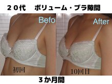 バストサロン メルベイユ(Merveile)/デコルテからふっくら隙間埋まる