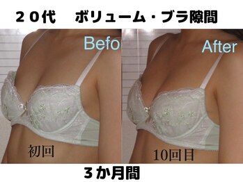 バストサロン メルベイユ(Merveile)/デコルテからふっくら隙間埋まる
