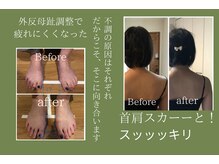ブライト(Bright)の雰囲気（不調の原因はそれぞれ。もしかしたら意外なところかも。）