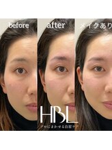 トゥルヌソル 宇都宮(tournesol)/ハリウッドブロウリフト