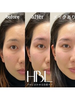 トゥルヌソル 宇都宮(tournesol)/ハリウッドブロウリフト