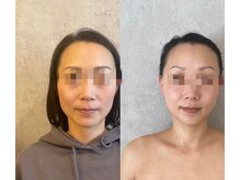 ラズ(Luz)/【小顔100分コース】