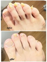 ラヴィ(La vie)/今さら聞けない爪切り