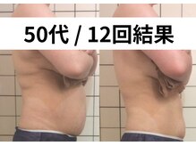 リストアミー(Restore me)/