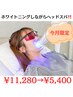 人気No.2 水光ホワイトニング＋ヘッドスパ¥11280→¥5,400