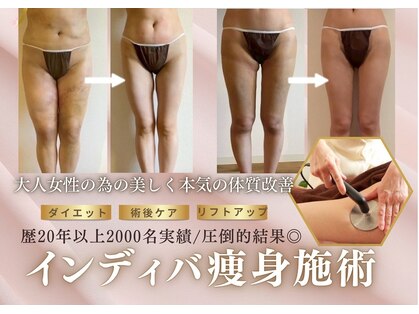 スリーピングビューティー(Sleeping Beauty)の写真