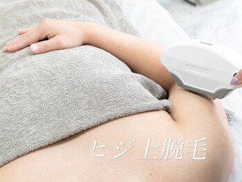 ボス 大垣店(BOSS)/ 【メンズ脱毛/上半身・両肘上】