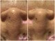 トータルビューティサロン リボーテ(Re:Beaute)の写真/その毛穴、諦めないで！黒ずみ・開き・たるみ毛穴もスッキリ◎正しいケアで引き締まったつるんと美肌へ☆