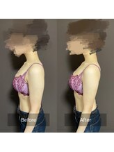 ハートランド(HEARTLAND)/プチ・クレオパトラ☆1回の施術