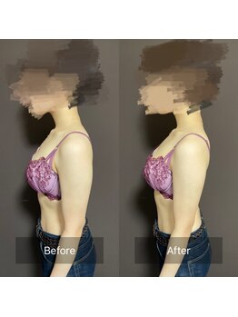 ハートランド(HEARTLAND)/プチ・クレオパトラ☆1回の施術