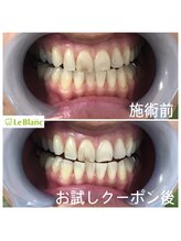 ルブラン 奈良店(Le Blanc)/目に見える着色汚れ