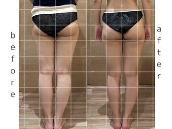 リア(Lia)/キャビ40分×6回の効果