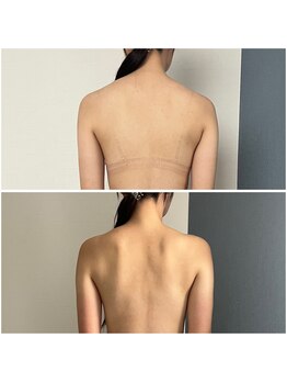 モア(moa)/背面スッキリ/ 巻肩 / 猫背