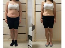 バランスアップラボ(バランスアップLAB)/★ダイエット整体Before＆After1