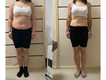 バランスアップラボ(バランスアップLAB)/★ダイエット整体Before＆After1