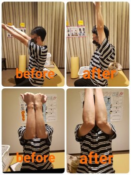 若松整体院 太白区院/肩甲骨はがし＆骨盤矯正★