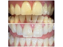 ホワイトニングルーム 横浜店(Whitening Room)/セルフホワイトニング/横浜